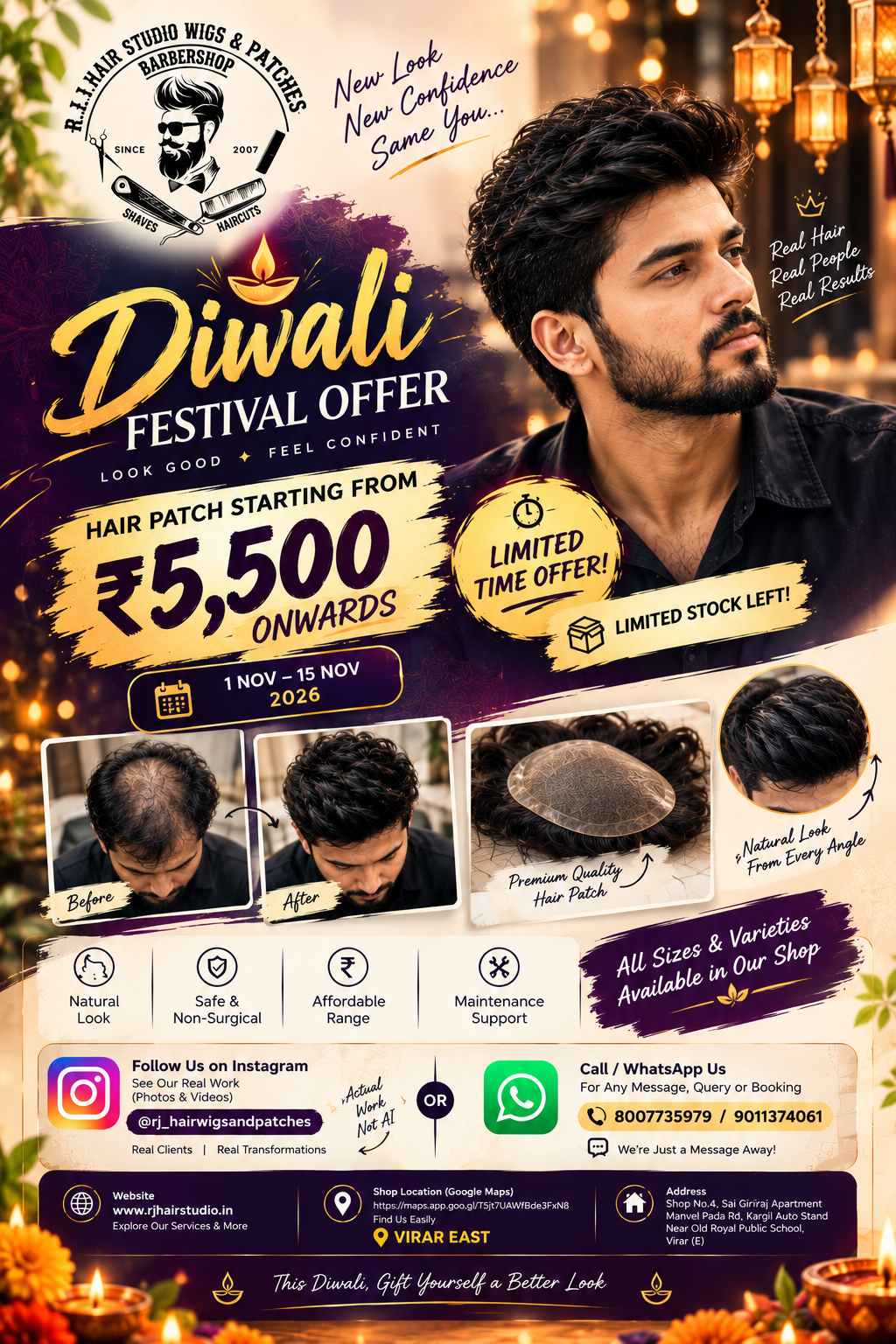 RJ Hair Weaving And Wigs Diwali Festival Offer: Hair Patch Starting From 5,500 Onwards